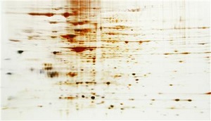 mass spectrometry, protein analysis