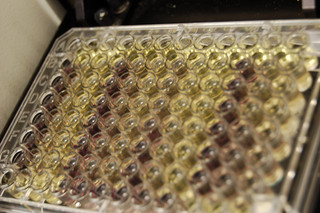 protein concentration