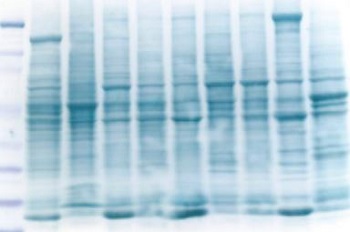protein detection, western blotting