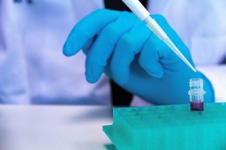 protein estimation assays
