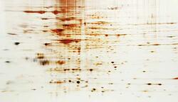A silver stained 2D electrophoresis gel