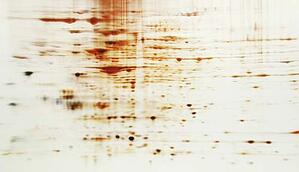 Protein electrophoresis