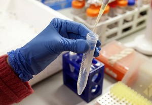 protein labelling