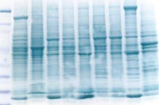 protein detection, western blotting