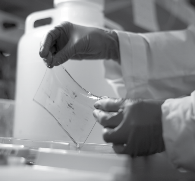 Interfering Agents of 2D Electrophoresis and How to Remove Them
