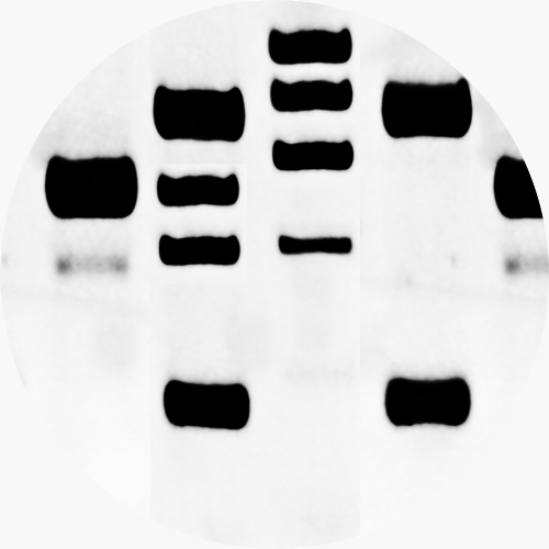 Western Blot Blocking: Tips and Tricks