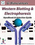 Western Blotting & Electrophoresis Handbook
