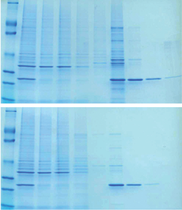 Protein Purification with IMAC