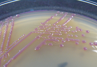 Reagents for Plasmid Purification and Colony Screening