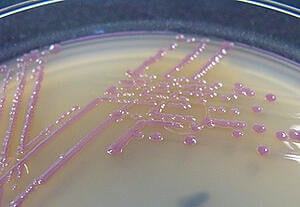 plasmid purification, colony screening