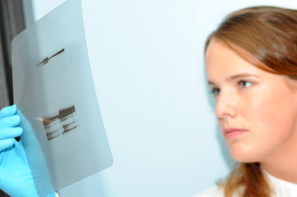 Non-Specific Binding: Why It Needs to be Blocked in Western blots!