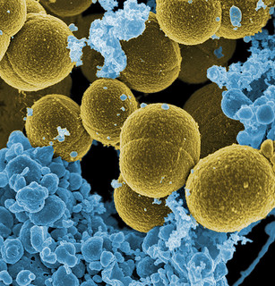 Plasmid DNA Isolation through Alkaline Lysis: How Does It Work?