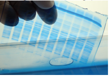 Understanding the Protein Electrophoresis Workflow (Part 3)