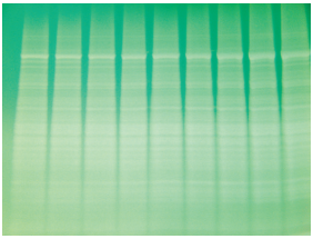 Understanding the Protein Electrophoresis Workflow (Part 2)