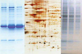 Dyes, Ions, or Fluorescent Stains: What Are the Best Ways to Visualize Protein In Gels?