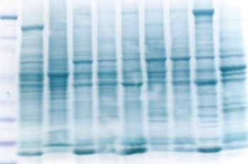 Using Western Blotting for Protein Detection: Some Commonly Used Methods (Part 2)