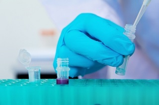 Sample Preparation for Western Transfer: A Definitive Guide
