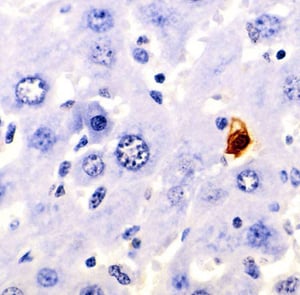 Apoptosis_stained