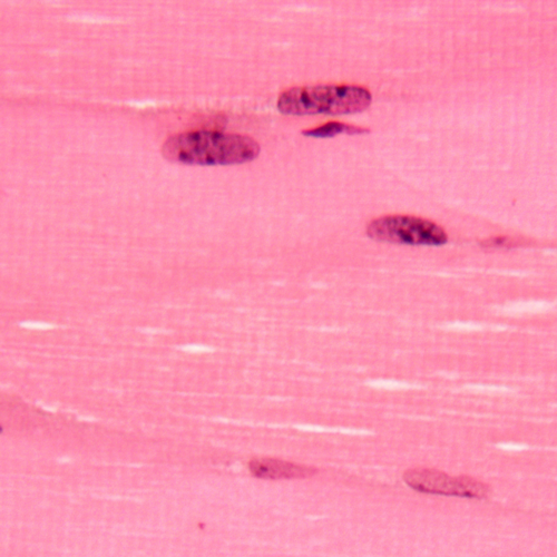 Key Differences of H&E and Special Stains for Immunohistochemistry