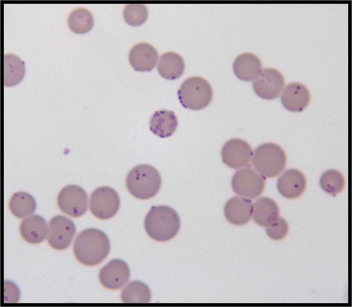 Mycoplasma Contamination in Cell Cultures: Detection & Prevention