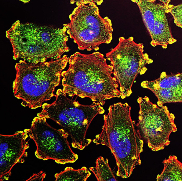 Revisiting Apoptosis