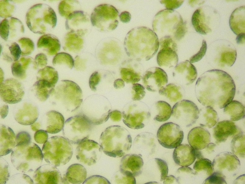 The Differences between a Protoplast and a Spheroplast (And Their Subsequent Uses)