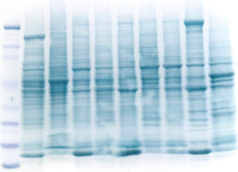 Best Methods to Stain Proteins After Protein Electrophoresis