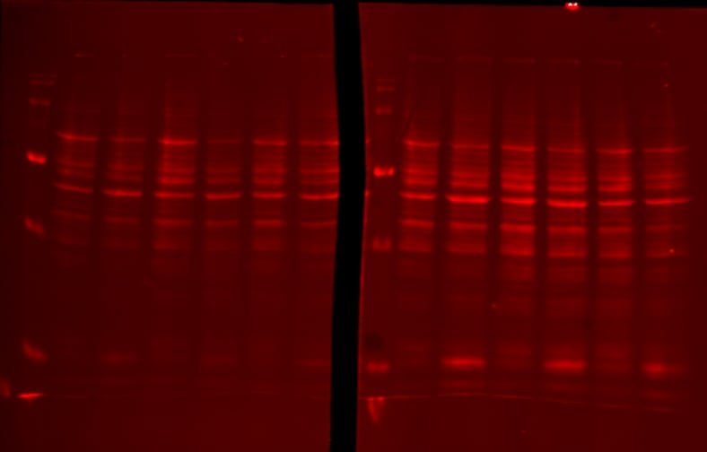 Are Total Protein Membrane Stains Compatible With IR Imaging Systems?