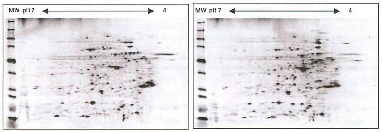Western Blot Blocking: Tips and Tricks for Blocking Agents